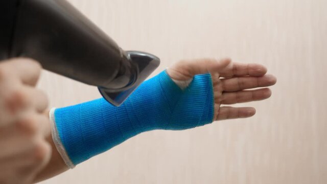 Broken wrist in fiberglass plaster cast after shower. Male hand wrapped in a modern waterproof bandage dries with a hairdryer