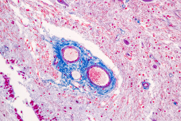 Education Spinal cord, Nerve, Cerebellum, Cortex and Motor Neuron Human under the microscope in...