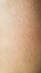 Haut Nahaufnahme Makro Haare Poren Rötung dermatologisch derma skin macro Reizung Pflege Punkte Härchen Zellen Papier Struktur