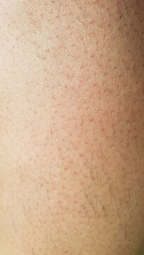 Haut Nahaufnahme Makro Haare Poren Rötung dermatologisch derma skin macro Reizung Pflege Punkte Härchen Zellen Papier Struktur