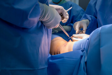 Close up photo of Surgeon in blue surgical gown suit working inside operating room.Selective focus at needle holder to suture wound in private hospital with blur background.Doctor wearing glove.