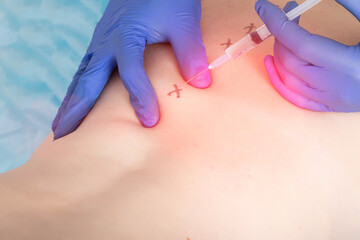 The doctor gives the patient's girl a medical injection of a blockade into the nerve plexuses of the sacro-lumbar region. Back pain treatment and pain relief concept. Copy space for text