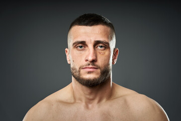 Fototapeta premium Bruised fighter on gray background