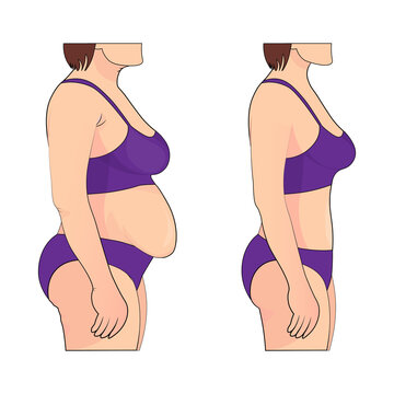 Woman s body before and after weight loss. Vector illustration.