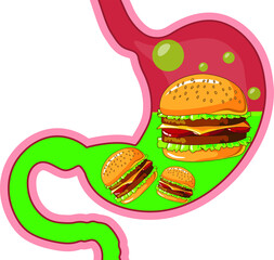 Human stomach. Medical drawing. Healthy stomach, digestive problems.