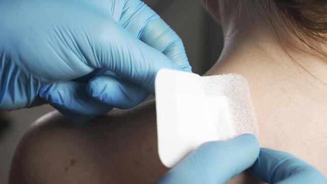 Doctor sticks a band-aid patch on the wound on the patient's back. A stitched wound on a woman's back. Doctor's hands close-up.