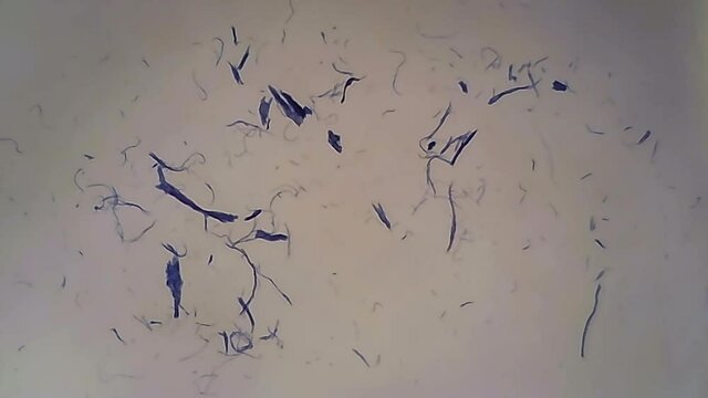 Microscope Human Smooth Muscle 600x