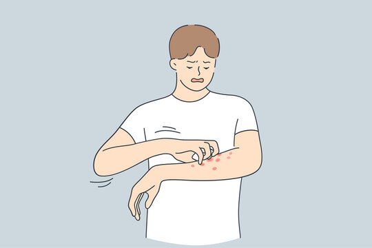 Skin Allergy, Dermatitis, Eczema Concept. Annoyed Young Man In White T-shirt Scratching Itch On His Arm Feeling Unhappy And Uncomfortable Vector Illustration 