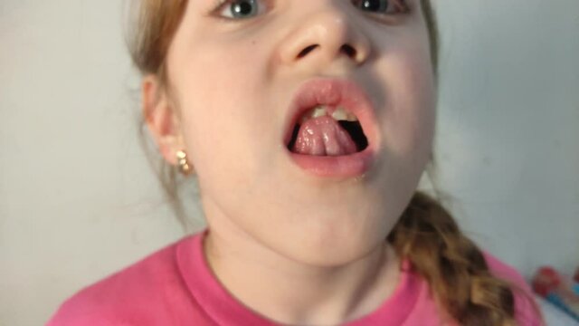 Little girl child wobbling her baby tooth