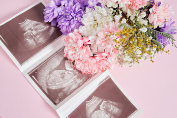 a snapshot of an ultrasound scan and flowers on a pink background pregnancy and motherhood concept, conscious parenthood