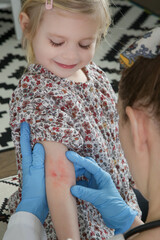 Doctor looking at red and itchy eczema on little girl's arm. Toddler girl suffering from atopic dermatitis.