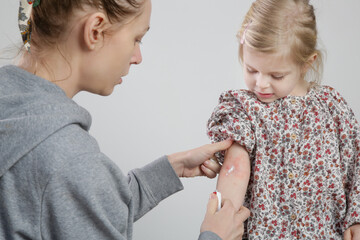 Mother applaying ointment onto red and itchy eczema on her daughter's arm. Toddler girl suffering...
