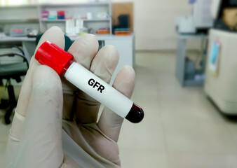 Blood sample for GFR test, eGFR, Creatinine, Bun. Closeup.