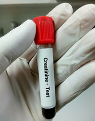 Blood sample for Renal Function Test. GFR, eGFR, Creatinine, Bun. Closeup.