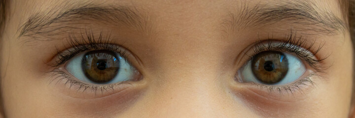 OLHO DE CRIANÇA DE 4 ANOS.