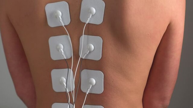 Physiotherapy of the back with TENS myostimulator, electrical nerve stimulation. Electrodes on the patient's back. The electrodes are designed for treatment, rehabilitation and tonicity.
