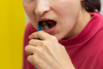 Girl with dental braces and brackets holding toothbrush for dental hygiene