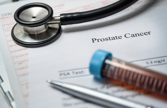 Studio shot of prostate cancer document, stethoscope and blood sample