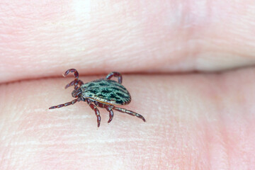 Lyme disease-carrier Ixodes tick Dermacentor marginatus on human skin.
