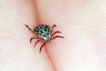 Lyme disease-carrier Ixodes tick Dermacentor marginatus on human skin.
