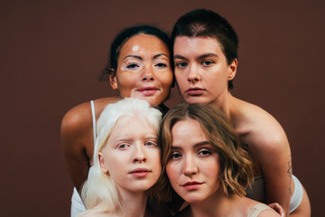 Obraz premium Group of multiethnic women with different kind of skin posing together in studio. Concept about body positivity and self acceptance