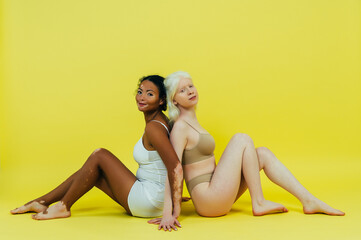 Diverse beauty concept with albinism and vitiligo