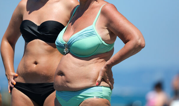 Two Old Women In Bathing Suits