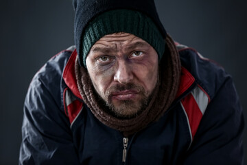 Portrait of poor homeless man on dark background