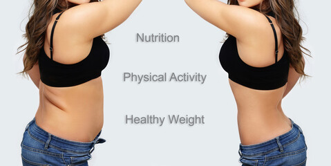 Weight loss, diet, abdominoplasty.female body