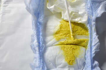 Rotavirus test for babies. Taking a poop sample for examination. Pooped diaper in a lab. Medical...