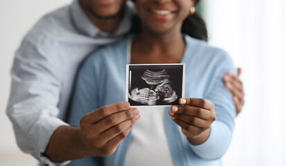 Closeup of baby sonogram in black couple hands
