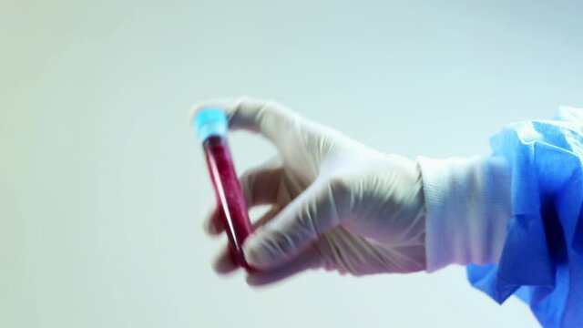 Blood test full tubes in doctor's hand with glove, on the white background, studio shoot.