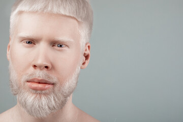 Portrait of albino bearded man with white hair and pale skin looking at camera, grey background...