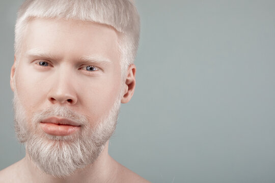 Portrait of albino bearded man with white hair and pale skin looking at camera, grey background with free space