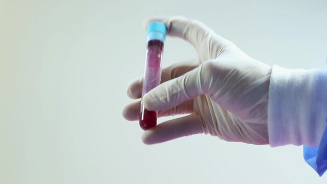 Blood test full tubes in doctor's hand with glove, on the white background, studio shoot.