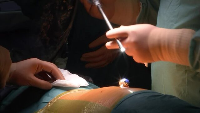 Surgeon performs a laparoscopic surgery. Clouse-up of doctor's hands and the medical tools.