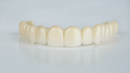 dental prosthesis of temporary wearing of the upper jaw on a white background © Dental Pro Content
