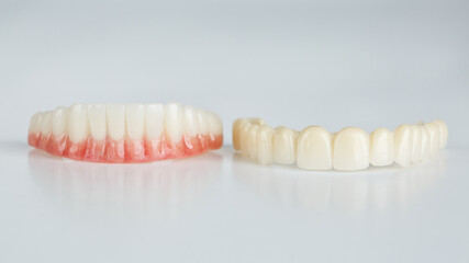 two dental prostheses for temporary wearing of the lower and upper jaws on a white background