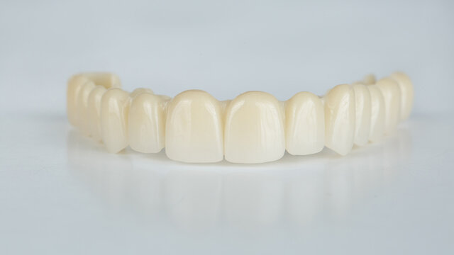 dental prosthesis of temporary wearing of the upper jaw on a white background