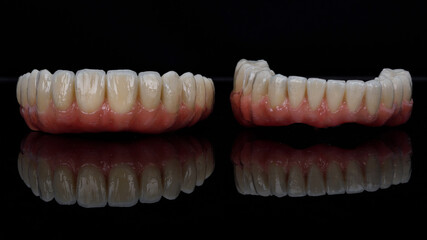 excellent dental prostheses made of ceramic and pink gums on black glass