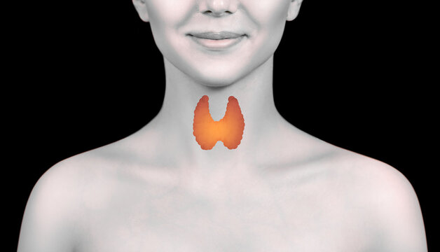 Young woman with visual thyroid on her sore. Thyroid control of women.