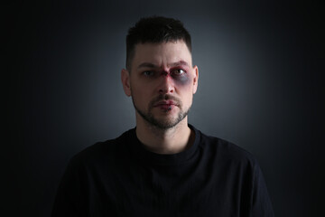 Fototapeta premium Man with facial injuries on dark background. Domestic violence victim