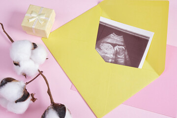 snapshot of an ultrasound scan in a yellow envelope on a pink background