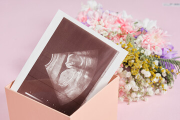 a snapshot of an ultrasound scan and flowers on a pink background pregnancy and motherhood concept, conscious parenthood