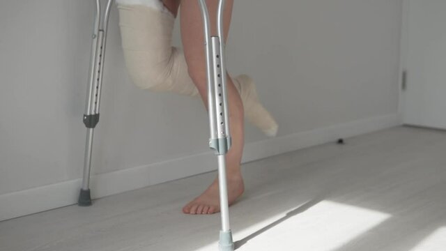 Close-up of her legs, a woman with a broken leg in a cast slowly walks on crutches on the hospital ward.