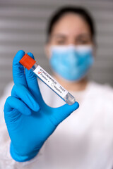 Unrecognizable nurse showing a test tube with a positive sample of Covid-19 virus. Selective focus.