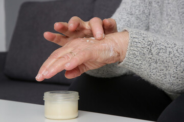 Fototapeta na wymiar Elderly woman with very dry skin applying moisturizing lotion on her arms 