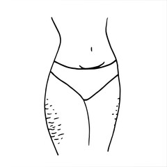 female hips with stretch marks - vector sketch. Black linear vector illustration of the lower body of a woman in underpants