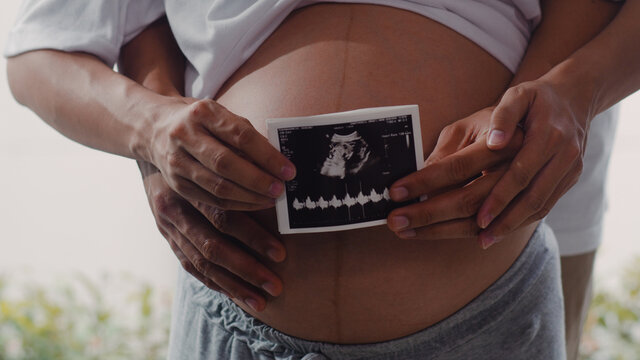 Young Asian Pregnant couple show and looking ultrasound photo baby in belly. Mom and Dad feeling happy smiling peaceful while take care child lying near window in living room at home concept.