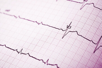 Electrocardiograph closeup view
